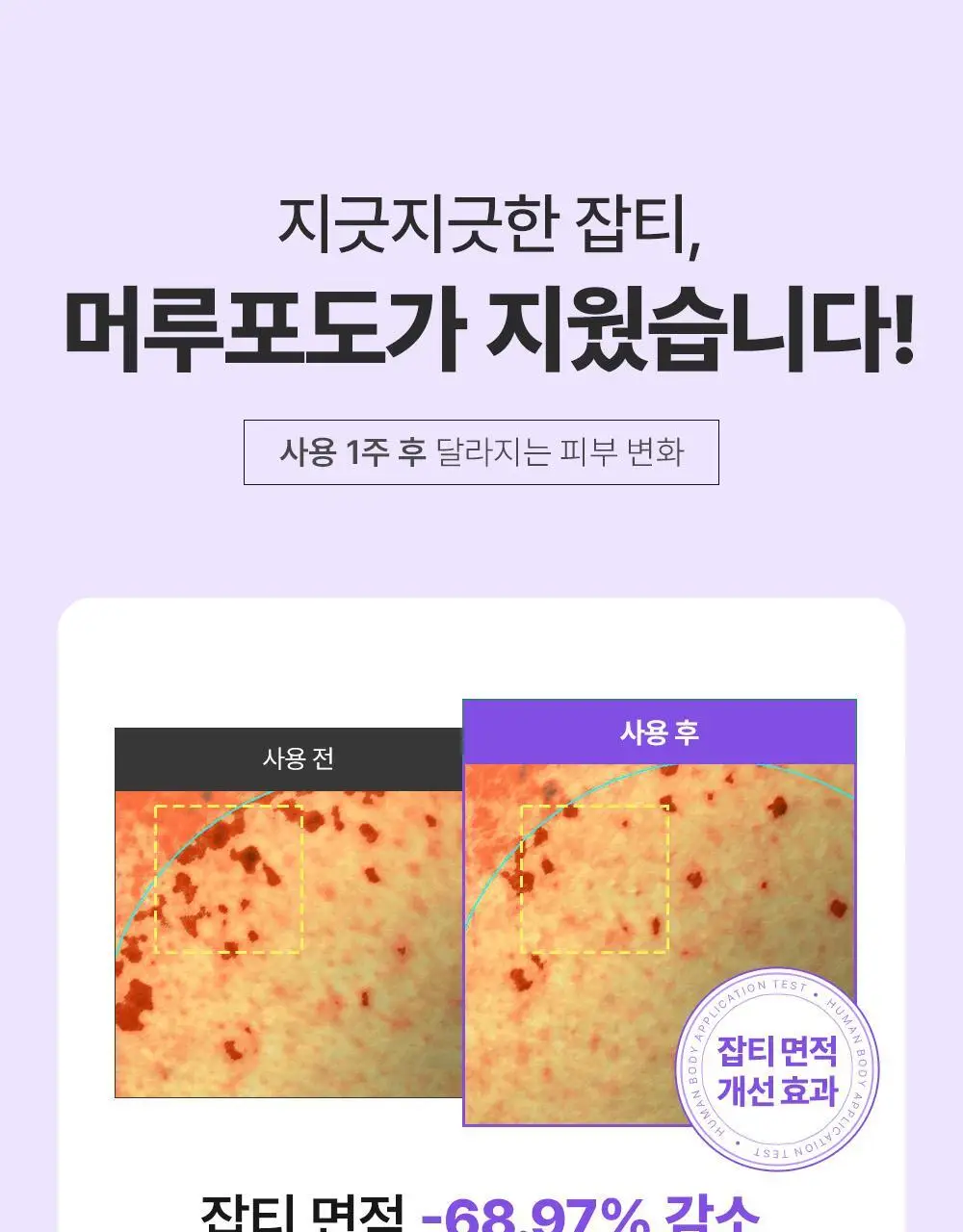 [잡티미백케어] 성분에디터 머루포도 비타 C 잡티크림 50g 상세페이지 9